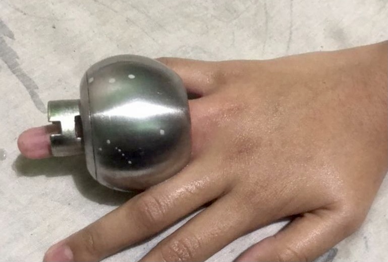 Tahan kesakitan selama sejam jari tersangkut di tombol pintu